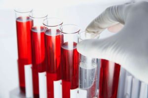 Анализ крови из вены на гормоны как подготовиться