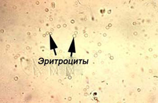 Микроскопические тела